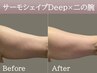 【脂肪燃焼/引き締め】サーモシェイプDeep（腕40分）＋カウンセリング30分