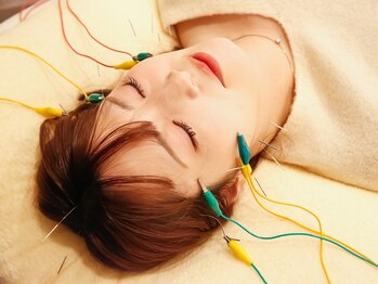芦屋楓鍼灸院の写真/美容鍼で顔のむくみ・ゆるんだフェイスラインをすっきり改善♪最短で理想の小顔に◎初心者にもオススメ★