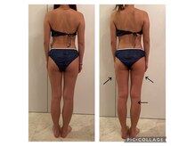 ラナ(LaNa)の雰囲気（落ちにくいセル脂肪を分解！食事制限、運動一切なしでも変わる★）