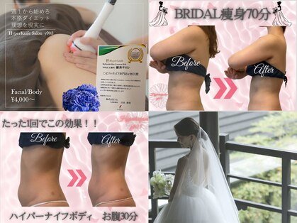 ワイキューマルサン(y903)の写真