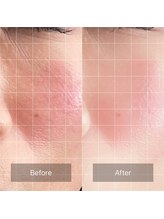 ウツクシ 三軒茶屋(UTUKUSHI)/before→after　