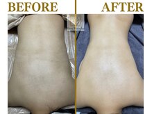 ヴェールブランシュ 町田(Vert Blanche)/#ブライダルエステ#毛穴#美白