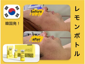 パリス 七尾店/韓国発！レモンボトルで小顔へ