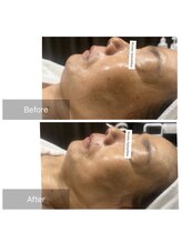 シン(Shin)/沖縄県初フェイシャル