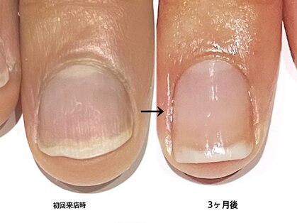 ブリエネイルの写真