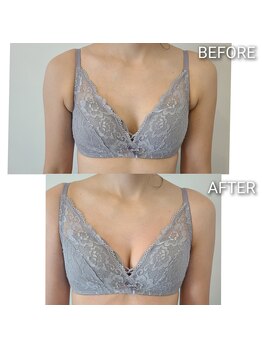 リンド(Lindo)/バストアップケア