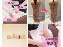 ラディアンス