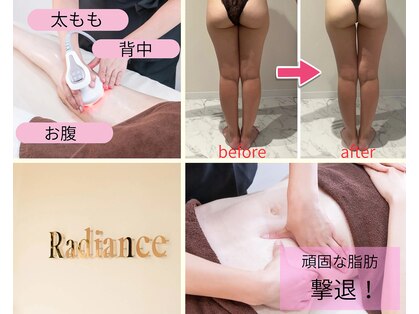 ラディアンスの写真