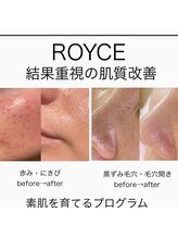 ロイズ(ROYCE)&nbsp;ROYCE YUUKI