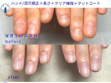 プラスワン(+1)の雰囲気（深爪、爪噛み、縦割れ、形...爪のお悩みを改善します[池袋]）