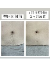 テンパ ビューティー(+10%beauty)/効果写真