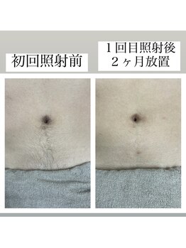 テンパ ビューティー(+10%beauty)/効果写真