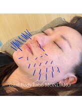 モンダロ(MONDARO)/美容鍼