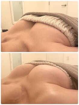 美人バスト 岡崎店/もりっとバストアップ！