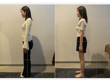 小顔矯正整体サロン イクサス(IxAS)/約3ヶ月/計6回の<before&after>