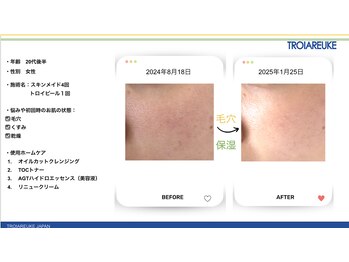 リトルーム(Litroom: from Seoul)/センシティブ管理