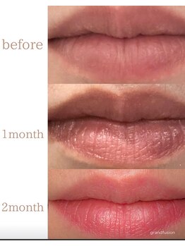 リュミエール デスポワール(Lumiere d'espoir)/ローマピンク