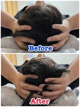 イデアル(iDeal)/頭スッキリ！サイズダウン