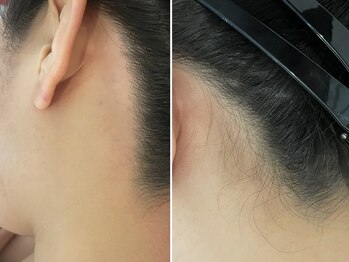 スタジオサンハチゴ(studio-385)/【うなじwax】女性