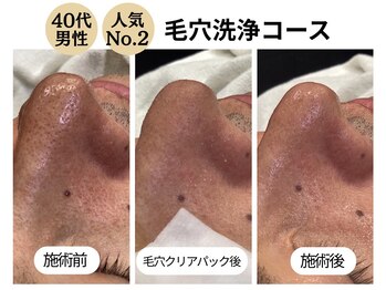 ディレイア ザ コスメ 有楽町マルイ店(direia the cosme)/メンズ/皮脂/角栓［有楽町］