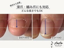 トトヘアー アンド ネイル(toto hair and nail)の雰囲気(【toto式】深爪・噛み爪改善*根本の原因からアプローチ)