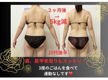 スマイルデイズ(Smiledays)の雰囲気（今夏はバックラインを美しく♪短期決戦で理想に近づきます。）