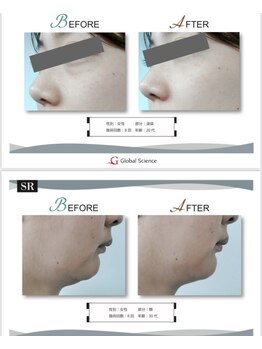 サンバイエム(#3/M)/フェイシャルケア