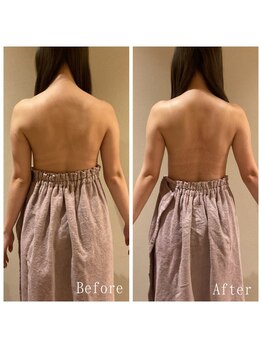 オクノマ(OKUNOMA)/【お客様BeforeAfter】