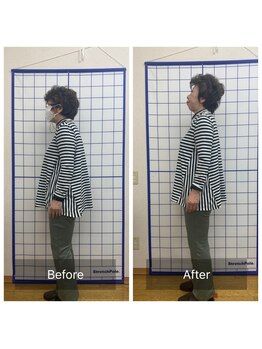 池川整骨院/姿勢矯正ビフォーアフター