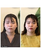 健幸堂 本店/小顔矯正1回→6回