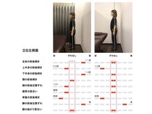 女性専用整体サロン　ベル 岩国店/ 【50代】姿勢Before After