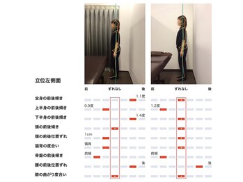女性専用整体サロン　ベル 岩国店/ 【50代】姿勢Before After