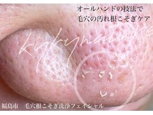 キュキュナチュレの雰囲気（繰り返す毛穴の悩みも本気の根本ケアで緩和を目指せます！）