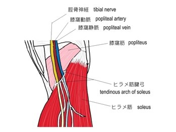ライズ/ヒラメ筋腱弓