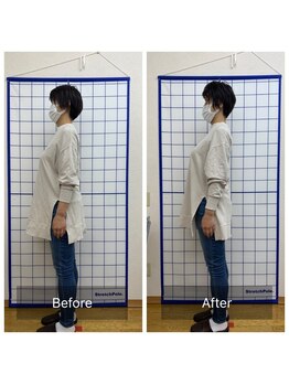 池川整骨院/姿勢矯正ビフォーアフター