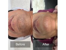 ビフォーアフター