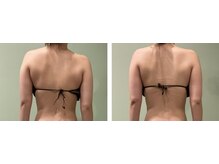 アトリエール(Ateliere)/☆奇跡の変化☆