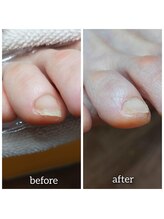 爪切り屋 足楽/