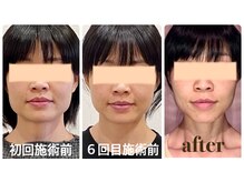 クリーム 福井店(Cream)の雰囲気（結果が分かる小顔矯正で気になるエラ張り・丸顔も徹底改善◎）