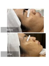 シン(Shin)/一回で効果抜群フェイシャル