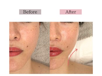 フロリール アザブジュウバン(FlorirAzabujuban)