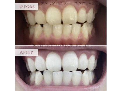 プティー(putih)の写真