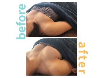 シエル(Ciel)/バストアップ施術１回