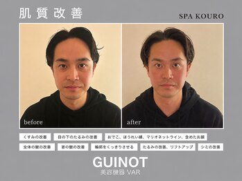 スパ 香炉の写真/第一印象は肌で変わる、リフトアップと肌質改善を同時に実現