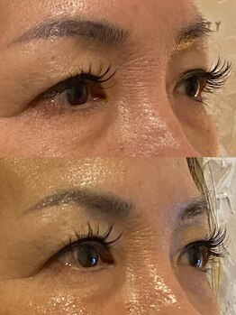 ビーアイリー(Be irie)/フェイシャルエステ直後の変化