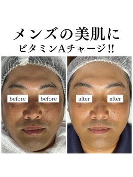 フェリス(FELIZ)/メンズの美肌に