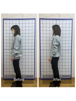 池川整骨院/姿勢矯正ビフォーアフター