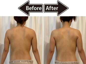 シェリ(Cherie)/ハイパーナイフで美背中くびれ♪