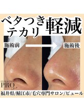 ピュール 鯖江店(PUR)/毛穴サロン/毛穴ケア/毛穴洗浄