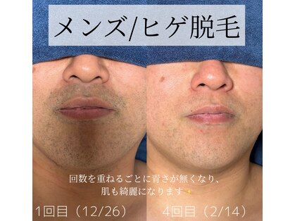 カナウ(KANAU)の写真